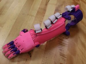 prosthetic arm