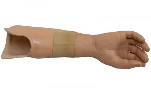 prosthetic arm